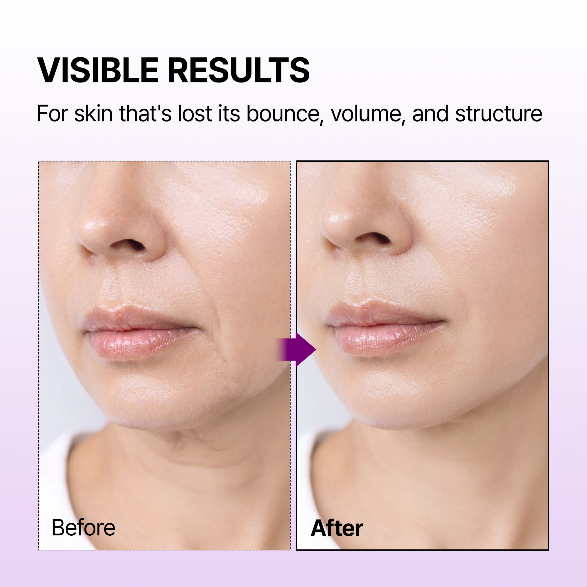 Calcium Bonding Serum