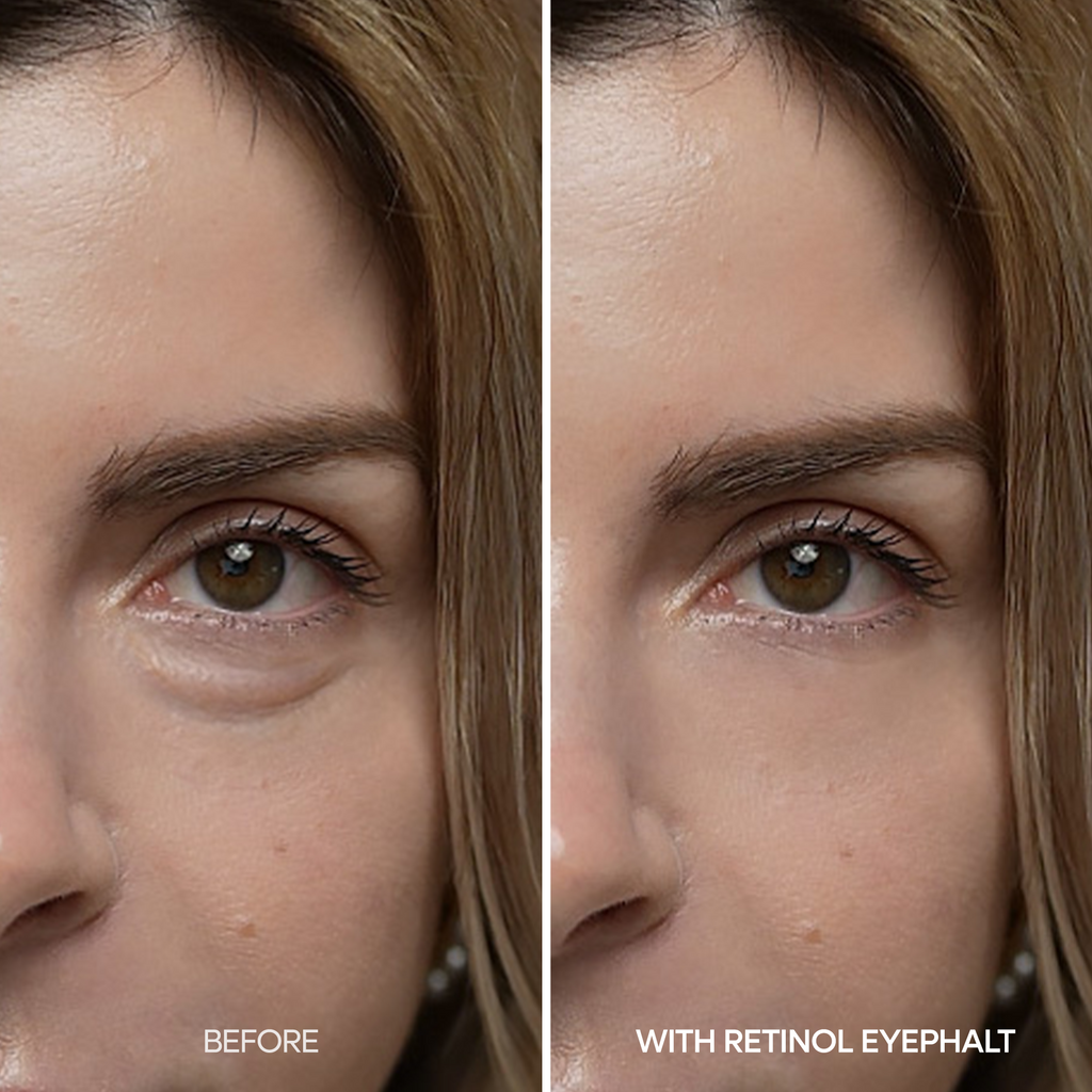 [Day&Night Care] Eyephalt Eyebag Lifting Line