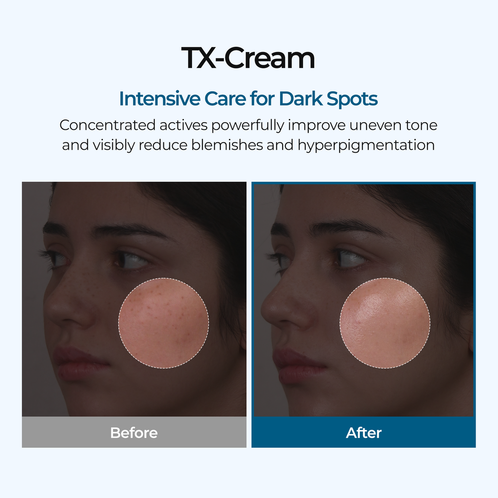 [Dr.Miriyalyad] TX Dark Spot Correcting Cream 50ml – Tranexamic Acid & Niacinamide Hyperpigmentation & Brightening Care