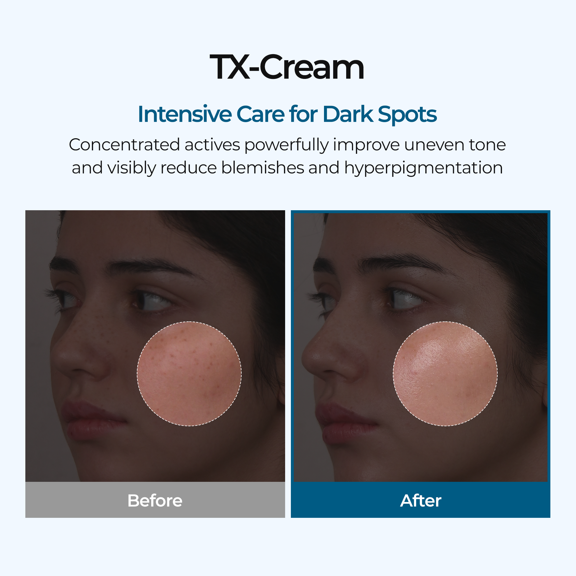 [Dr.Miriyalyad] TX Dark Spot Correcting Cream 50ml – Tranexamic Acid & Niacinamide Hyperpigmentation & Brightening Care
