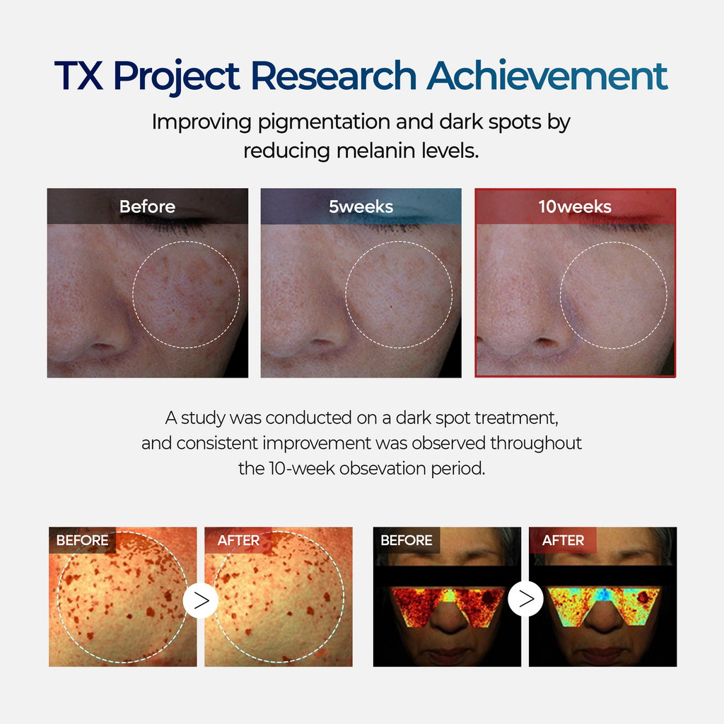 [Dr.Miriyalyad] TX Dark Spot Correcting Cream 50ml – Tranexamic Acid & Niacinamide Hyperpigmentation & Brightening Care