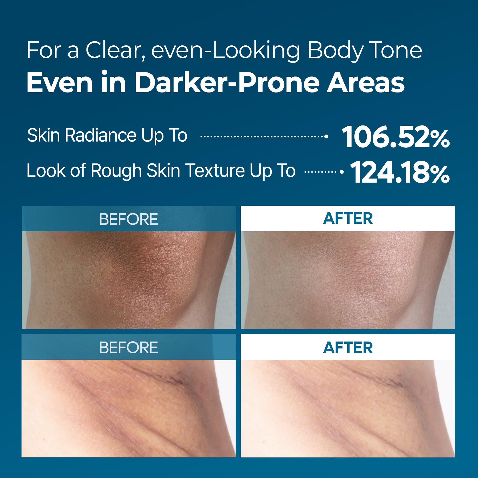 Peel Shot Exfoliating TX Spray