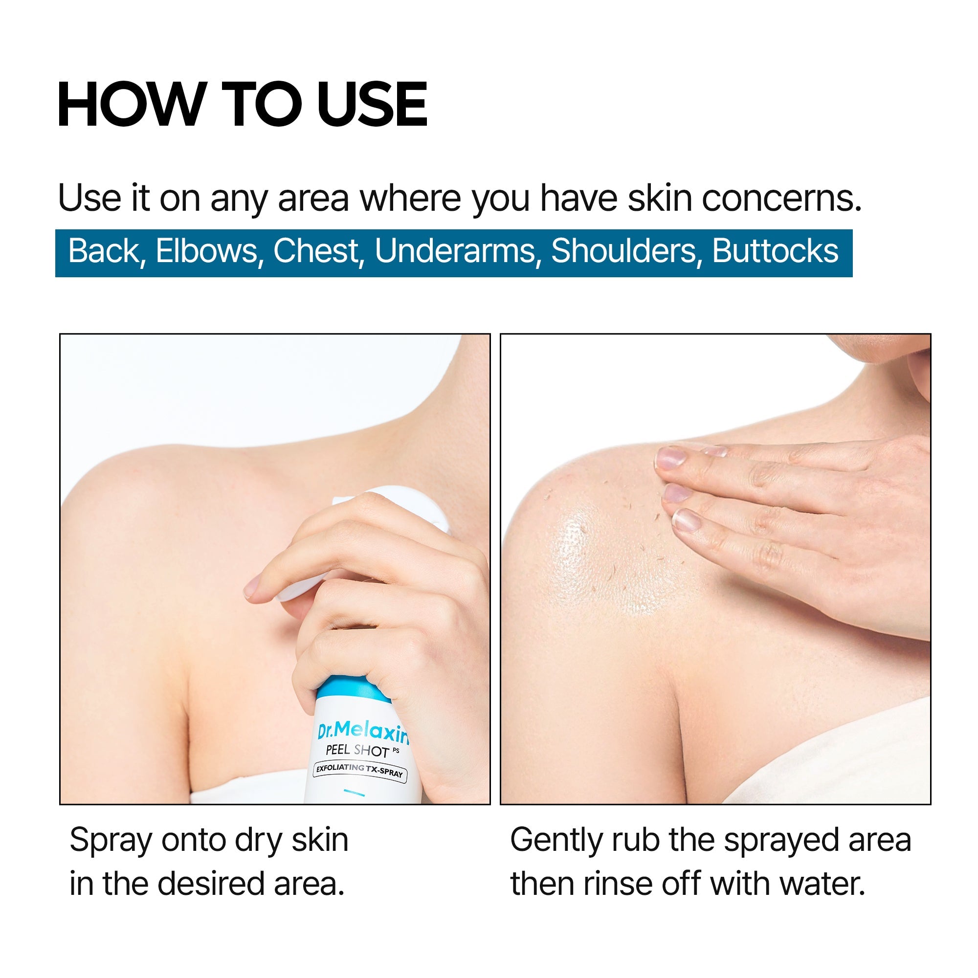 Peel Shot Exfoliating TX Spray